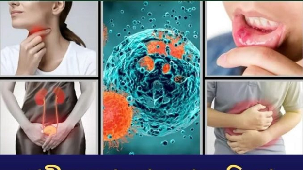 শরীরে ক্যা’ন্সার আছে কি না বুঝে নিন লক্ষণ দেখেই!